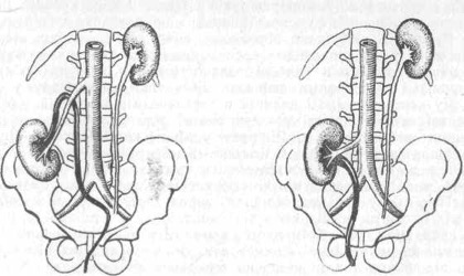 kidney